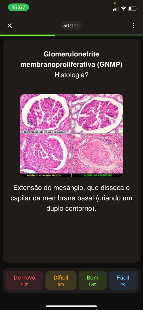 Flashcard 10