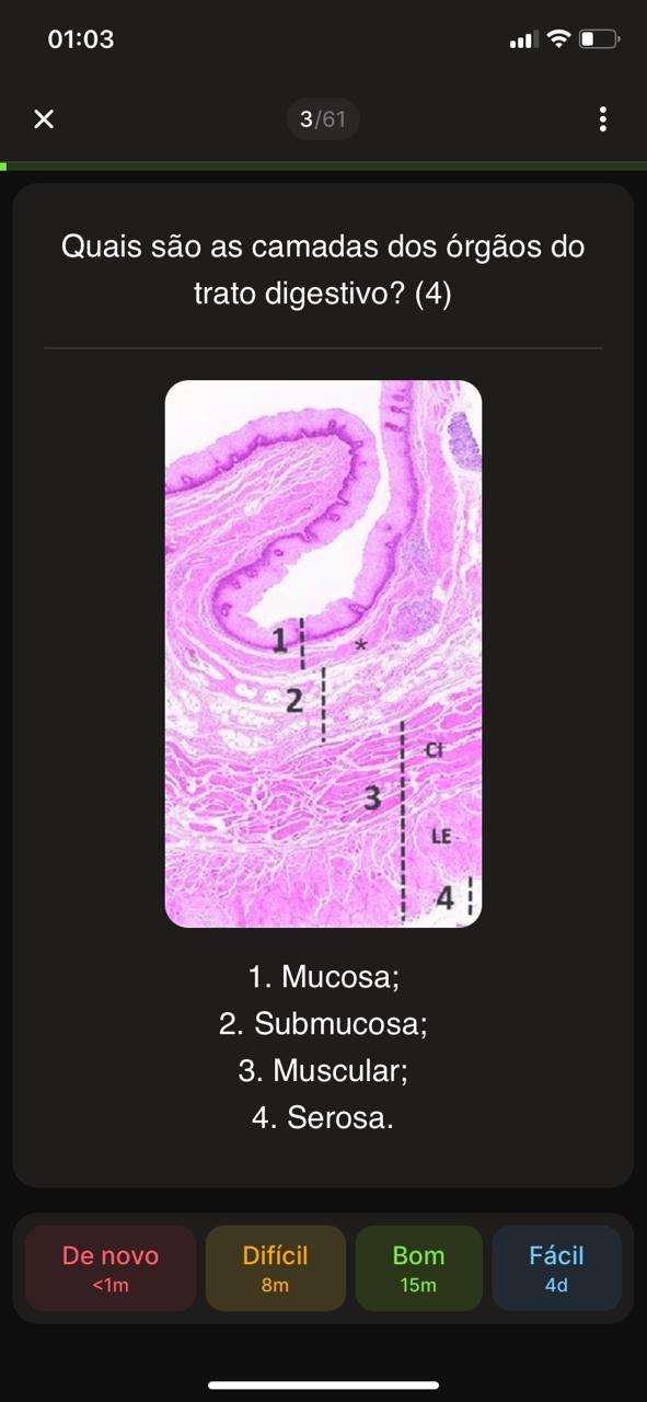 Flashcard 4