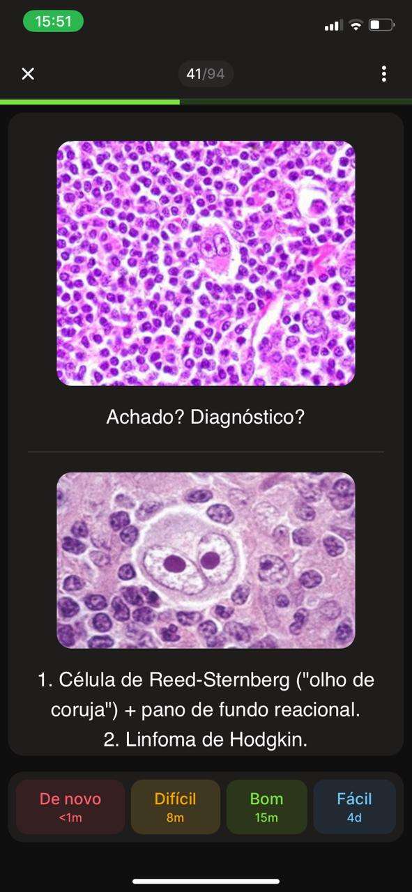 Flashcard 7