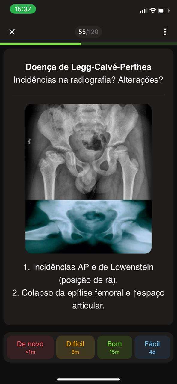 Flashcard 8